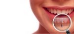 آیا کاشت دندان محدودیت سنی دارد؟